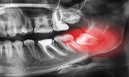 Oral, Dental, and Maxillofacial Surgery