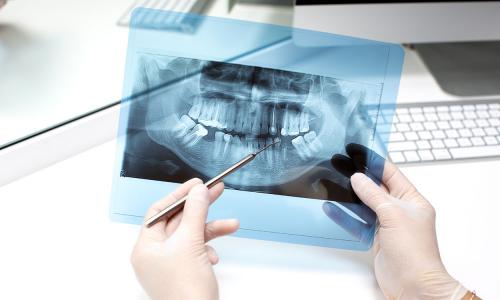 Dental Radyoloji